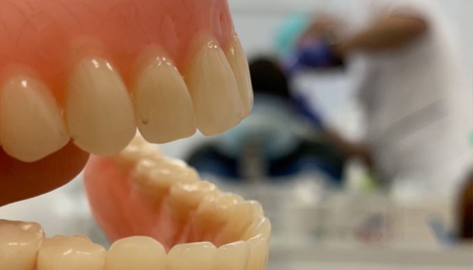 Керамические вкладки