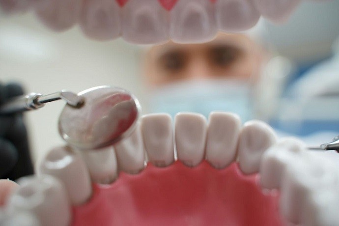 Имплантация передних зубов