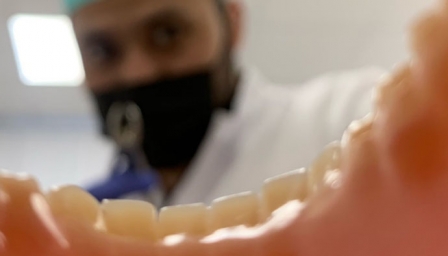 Мягкий съемный протез «Акри фри»