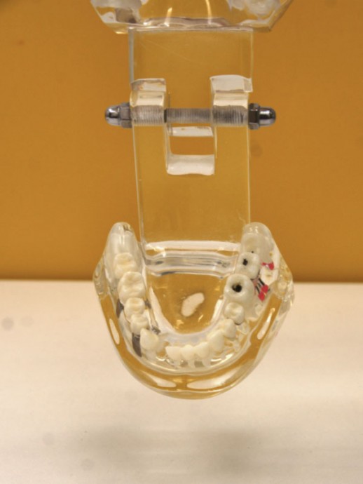 Профгигиена полости рта