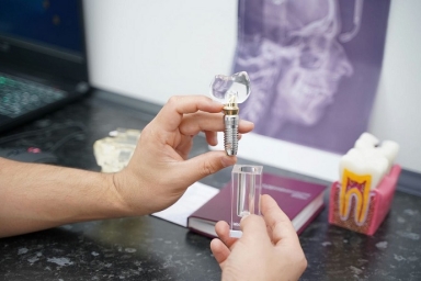 Имплантация зубов